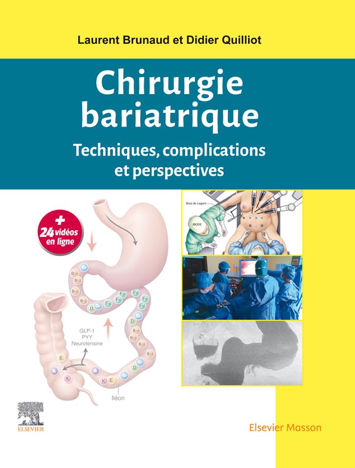 CHIRURGIE BARIATRIQUE : Techniques, complications et perspectives  Mai 2019 - Page 3 30L5m