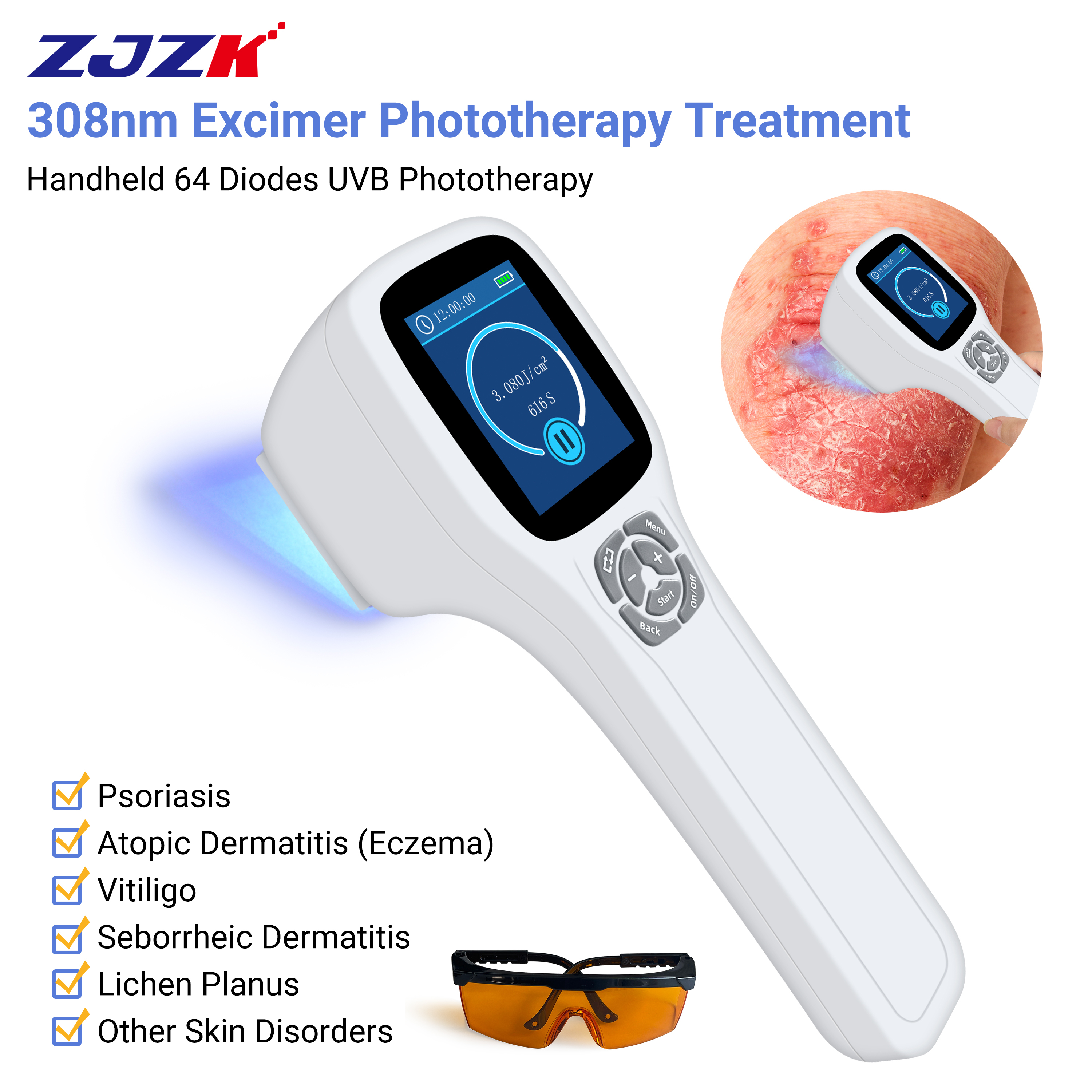 308nm Excimer System in Dermatology Phototherapy Light for Skin