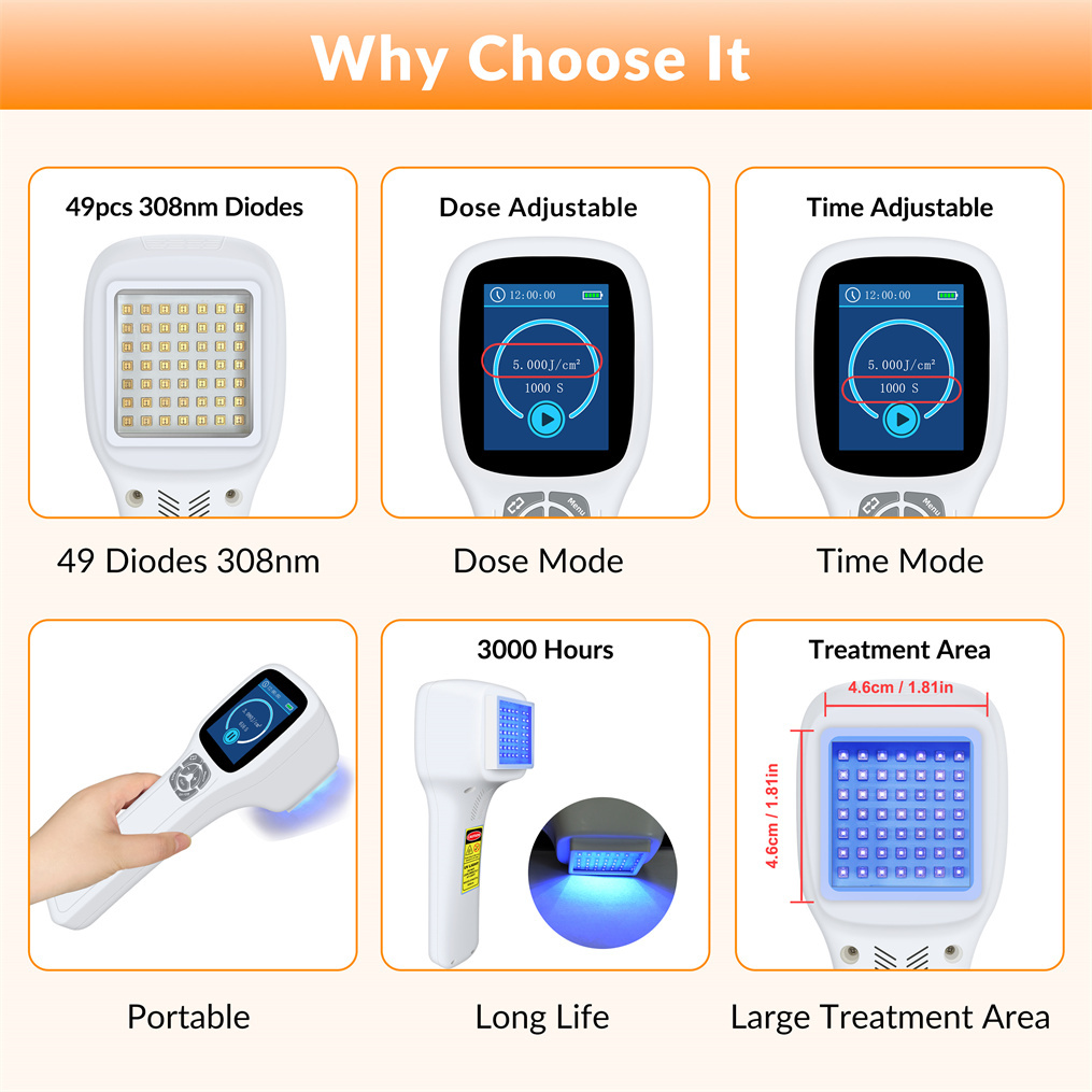 308nm Narrowband UVB Light UV Light Therapy UV Light for Skin